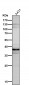 Anti-DKK1 Rabbit Monoclonal Antibody